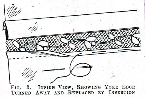 Figure 3: Inside View Showing Yoke Edge Turned Away and Replaced with Insertion